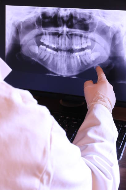 Best Emergency Wisdom Teeth Removal in Chicopee, MA