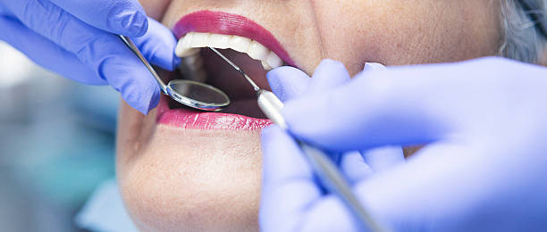 Best Urgent Care for Lost Fillings or Crowns in Chicopee, MA