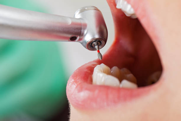 Best Cosmetic Emergency Dentistry in Chicopee, MA